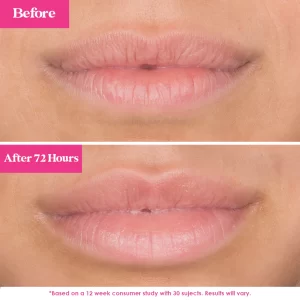 GrandePOUT Plumping Lip Mask - Image 4