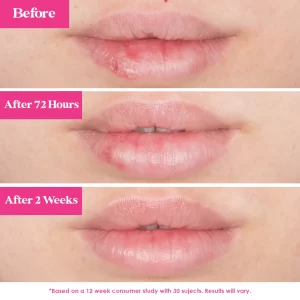GrandePOUT Plumping Lip Mask - Image 5